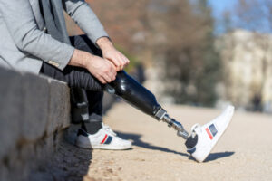Homme assis dehors qui abaisse son pantalon sur sa prothèse de jambe.